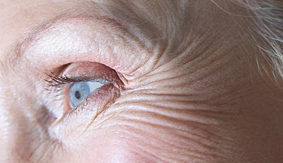 Understanding the Creases Around Your Eye Area Skin
