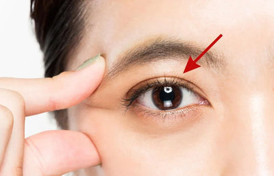 Understanding Single and Double Eyelids: Why are there Differences?