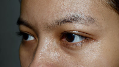 5 reasons why your eyelids need special care