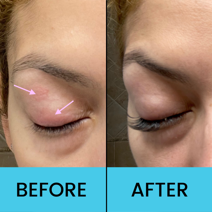 Soothe Operator Rollerball Eyelid Serum – You & Eye by Dr. Nicky